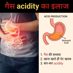 Gas acidity ka ilaj
